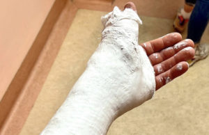 MANO SINISTRA FATTURATA E GIA’ INGESSATA PER BRAD FREMAN IN CONSEGUENZA DELLA CADUTA DI SABATO AL GP DEL PORTOGALLO